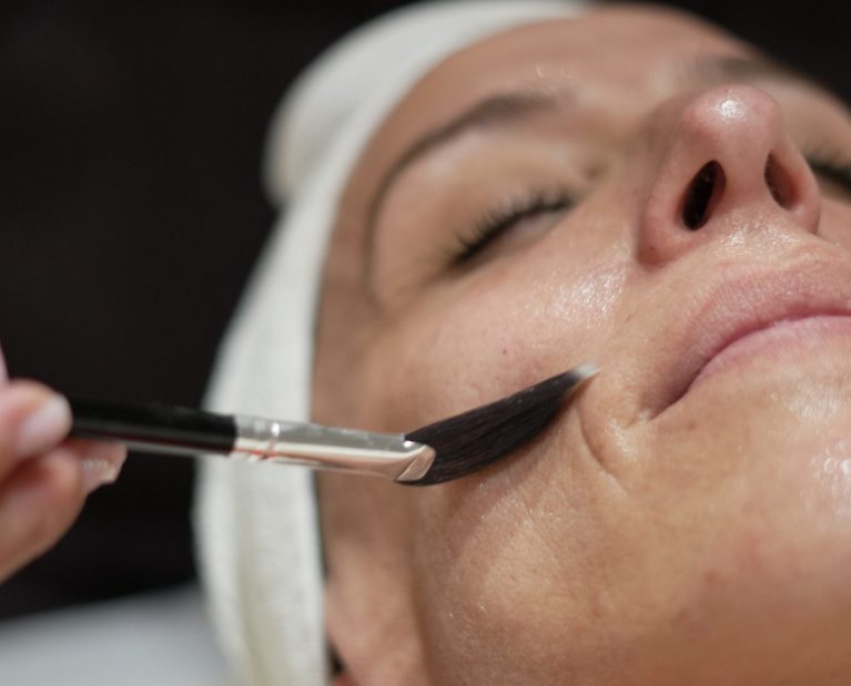 3 cuidar la piel-sin rellenos-naturalidad-Murcia-Esse Clinic