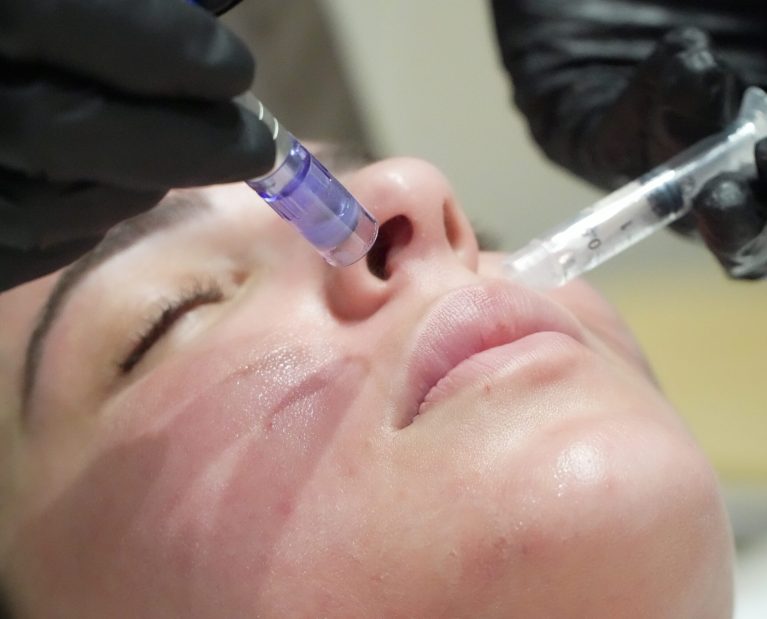 4. luminosidad-el tratamiento mas buscado-verano-piel-Esse Clinic-Murcia