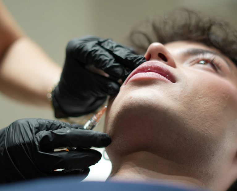 aumento-labios-naturalidad-Esse Clinic-Murcia