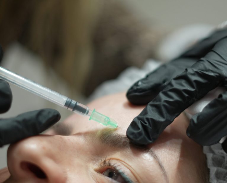 botox-arrugas-beneficios-Esse Clinic-Murcia