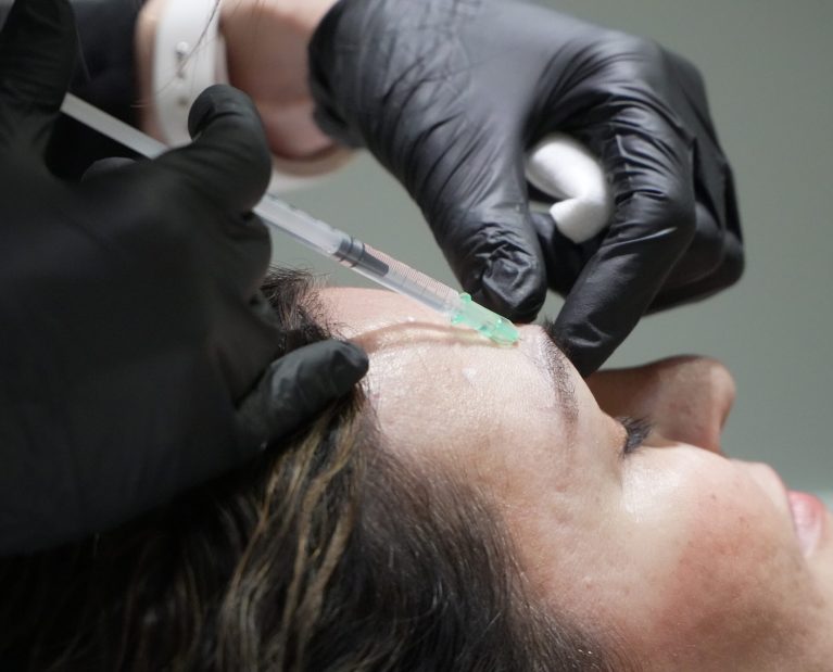 botox-duracion-tiempo-Esse Clinic