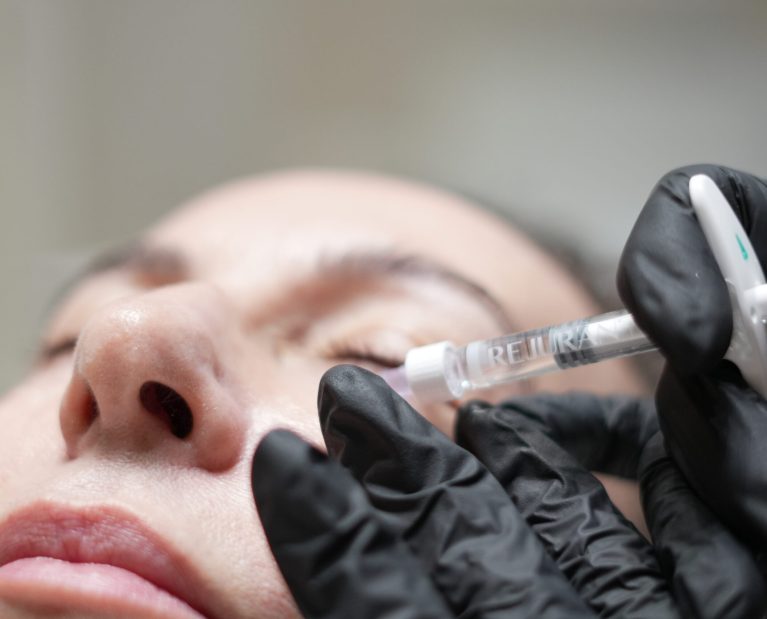 polinucleotidos-Esse Clinic-Murcia-resultados naturales